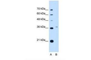 Image no. 2 for anti-Peroxisomal Biogenesis Factor 3 (PEX3) (AA 31-80) antibody (ABIN321040) (PEX3 抗体  (AA 31-80))