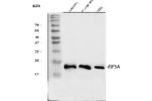 Western blot analysis of EIF5A using anti-EIF5A antibody (ABIN7602568). (EIF5A 抗体  (AA 86-154))