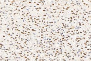 Immunohistochemistry analysis of paraffin-embedded human liver using,SET (ABIN7075583) at dilution of 1: 10000 (SET/TAF-I 抗体)
