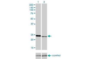 Western blot analysis of RAB7L1 over-expressed 293 cell line, cotransfected with RAB7L1 Validated Chimera RNAi (Lane 2) or non-transfected control (Lane 1). (RAB7L1 抗体  (AA 1-203))