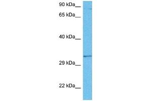 Host:  Rat  Target Name:  GTF2B  Sample Tissue:  Rat Brain  Antibody Dilution:  1ug/ml (GTF2B 抗体  (N-Term))