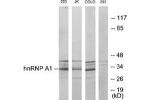 Western blot analysis of extracts from 293/Jurkat/COLO205 cells, using hnRNP A1 Antibody. (HNRNPA1 抗体  (AA 51-100))