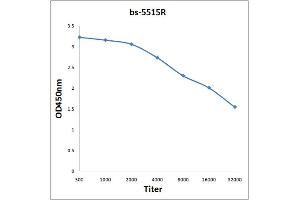 ELISA image for anti-Nuclear Factor of kappa Light Polypeptide Gene Enhancer in B-Cells Inhibitor, alpha (NFKBIA) (pTyr305) antibody (ABIN710696)
