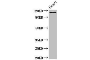 Western Blot Positive WB detected in: Mouse heart tissue All lanes: ITGA5 antibody at 4 μg/mL Secondary Goat polyclonal to rabbit IgG at 1/50000 dilution Predicted band size: 115 kDa Observed band size: 115 kDa (ITGA5 抗体  (AA 220-472))