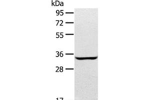 Western Blot analysis of A172 cell using STX2 Polyclonal Antibody at dilution of 1:400 (STX2 抗体)