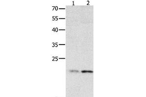 Western Blot analysis of 231 cell and Human fetal liver tissue using HMGB4 Polyclonal Antibody at dilution of 1:500 (HMGB4 抗体)