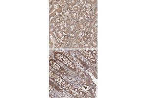 Immunohistochemical staining of human rectum with ARHGEF10L polyclonal antibody  shows strong cytoplasmic positivity. (ARHGEF10L 抗体)