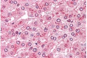 Human Liver: Formalin-Fixed, Paraffin-Embedded (FFPE) (ERAP1 抗体  (Internal Region))