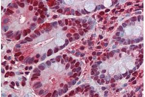 Human Small Intestine: Formalin-Fixed, Paraffin-Embedded (FFPE) (HDAC1 抗体  (AA 1-483))