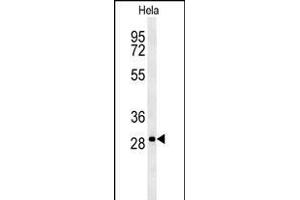 T Antibody (N-term) (ABIN651700 and ABIN2840367) western blot analysis in Hela cell line lysates (35 μg/lane). (TMEM165 抗体  (N-Term))