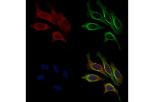 ABIN6258657 and ABIN6275971 staining HepG2 cells by IF/ICC.