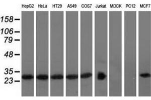 Western blot analysis of extracts (35 µg) from 9 different cell lines by using anti-RABL2A monoclonal antibody. (RABL2A 抗体)