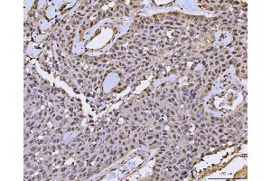 IHC analysis of FIP1L1 using anti-FIP1L1 antibody (ABIN7600761). (FIP1L1 抗体  (AA 23-558))