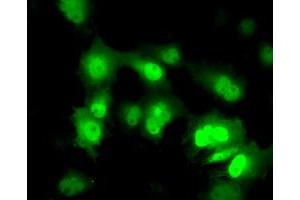 Anti-PPME1 mouse monoclonal antibody (ABIN2453495) immunofluorescent staining of COS7 cells transiently transfected by pCMV6-ENTRY PPME1 (RC200009). (PPME1 抗体)