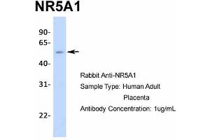 Western Blotting (WB) image for anti-Nuclear Receptor Subfamily 5, Group A, Member 1 (NR5A1) (Middle Region) antibody (ABIN2777447)
