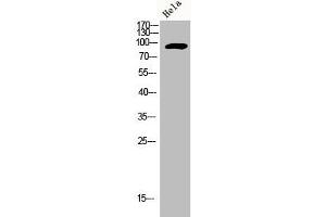 Western Blot analysis of HELA cells using Adducin α/β Polyclonal Antibody (alpha Adducin 抗体)
