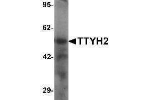 Western blot analysis of TTYH2 in human kidney tissue lysate with TTYH2 antibody at 1 µg/mL (TTYH2 抗体  (N-Term))