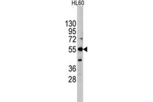 Image no. 1 for anti-Intestinal Alkaline Phosphatase (ALPI) (Center) antibody (ABIN356999)