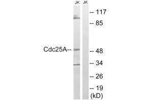 Western blot analysis of extracts from Jurkat cells, using CDC25A (Ab-178) antibody. (CDC25A 抗体  (Ser178))