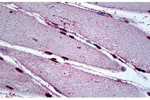 Human Skeletal Muscle: Formalin-Fixed, Paraffin-Embedded (FFPE) (MEOX2 抗体  (AA 1-304))