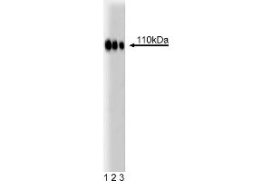 Western Blotting (WB) image for anti-Espin (ESPN) (AA 458-580) antibody (ABIN968627) (Espin 抗体  (AA 458-580))