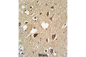Formalin-fixed and paraffin-embedded human brain tissue reacted with SUMO1 Antibody, which was peroxidase-conjugated to the secondary antibody, followed by DAB staining. (SUMO1 抗体)