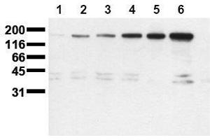 Western Blotting (WB) image for anti-Receptor tyrosine-protein kinase erbB-2 (ErbB2/Her2) (pSer1113) antibody (ABIN126790) (ErbB2/Her2 抗体  (pSer1113))