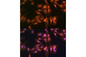 Immunofluorescence (IF) image for anti-S100 Calcium Binding Protein A14 (S100A14) (AA 1-104) antibody (ABIN6147339)