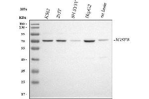 Western blot analysis of CD316/IGSF8 using anti-CD316/IGSF8 antibody (ABIN7600910).