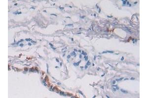 Detection of P4Ha2 in Human Pancreas Tissue using Polyclonal Antibody to Prolyl-4-Hydroxylase Alpha Polypeptide II (P4Ha2) (P4HA2 抗体  (AA 207-520))