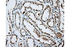 Immunohistochemical staining of paraffin-embedded Kidney tissue using anti-ARNT mouse monoclonal antibody. (ARNT 抗体)