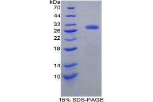 SDS-PAGE analysis of Rat Dopamine Receptor D2 Protein. (Dopamine d2 Receptor 蛋白)