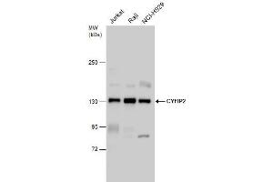 WB Image CYFIP2 antibody detects CYFIP2 protein by western blot analysis. (CYFIP2 抗体)