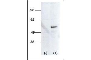 Western blot analysis of anti-STK38L Pab transiently transfected HEK-293 cell line lysate (1ug/lane). (STK38L 抗体  (C-Term))