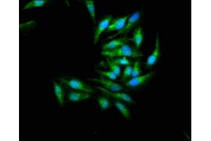 Immunofluorescence staining of Hela cells with ABIN7160013 at 1:266, counter-stained with DAPI. (JNK2 抗体  (AA 1-424))