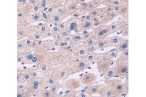 Immunohistochemistry (IHC) image for anti-Insulin-Like Growth Factor Binding Protein 3 (IGFBP3) antibody (ABIN1172095)