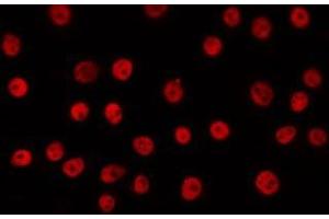 Immunofluorescence (fixed cells) (IF/ICC) image for anti-POU domain, class 2, transcription factor 2 (POU2F2) antibody (ABIN6263800)