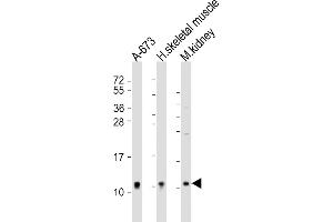 Western Blotting (WB) image for anti-NADH Dehydrogenase (Ubiquinone) 1 alpha Subcomplex, 1, 7.5kDa (NDUFA1) (AA 26-59) antibody (ABIN6243907)