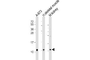 All lanes : Anti-NDUFA1 Antibody (Center) at 1:2000 dilution Lane 1: A-673 whole cell lysate Lane 2: human skeletal muscle lysate Lane 3: mouse kidney lysate Lysates/proteins at 20 μg per lane. (NDUFA1 抗体  (AA 26-59))