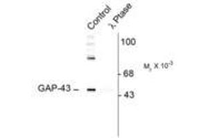 Image no. 1 for anti-Growth Associated Protein 43 (GAP43) (pSer41) antibody (ABIN227321) (GAP43 抗体  (pSer41))