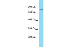 Host: Rabbit Target Name: ZYG11A Sample Type: Hela Whole Cell lysates Antibody Dilution: 1. (ZYG11A 抗体  (C-Term))
