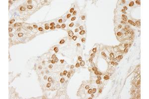 Immunohistochemistry (IHC) image for anti-WD Repeat Domain 77 (WDR77) (AA 292-342) antibody (ABIN7449034) (WDR77 抗体  (AA 292-342))