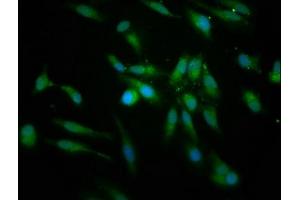 Immunofluorescence staining of Hela cells with ABIN7158776 at 1:166, counter-stained with DAPI. (PRCP 抗体  (AA 347-443))