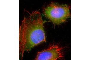 Immunofluorescent analysis of 4 % paraformaldehyde-fixed, 0. (HSD17B10 抗体  (AA 140-172))