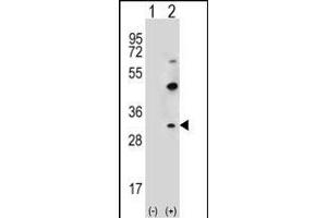 Western blot analysis of CLDN2 (arrow) using rabbit polyclonal CLDN2 Antibody  (ABIN656563 and ABIN2845823). (Claudin 2 抗体  (C-Term))