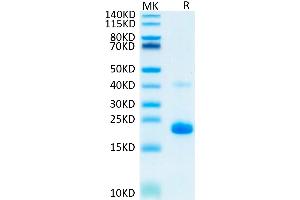 TNF alpha Protein (AA 77-233) (His-Avi Tag)