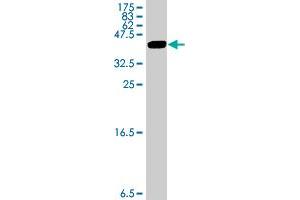 Western Blot detection against Immunogen (33. (MAGEA3 抗体  (AA 44-114))