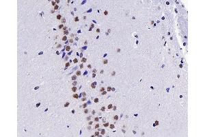 Immunohistochemistry analysis of paraffin-embedded Rat brain using c-Fos Polyclonal Antibody at dilution of 1:200. (c-FOS 抗体)