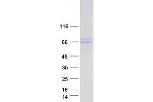Western Blotting (WB) image for Estrogen Receptor 1 (ESR1) (Transcript Variant 3) protein (Myc-DYKDDDDK Tag) (ABIN2720539)