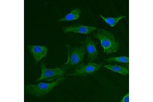 IF analysis of TRIM25 using anti-TRIM25 antibody (ABIN7599495). (TRIM25 抗体  (AA 1-610))